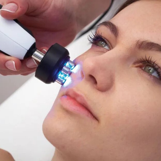 RF лифтинг лица (РФ)