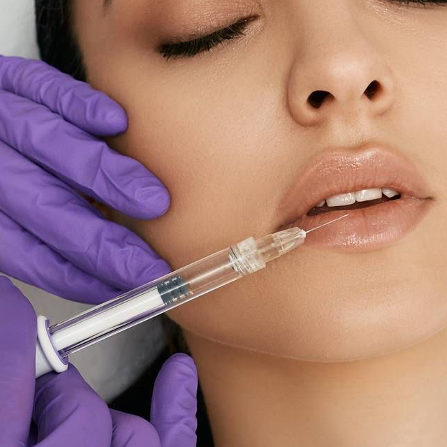 Belotero balance 1 ml