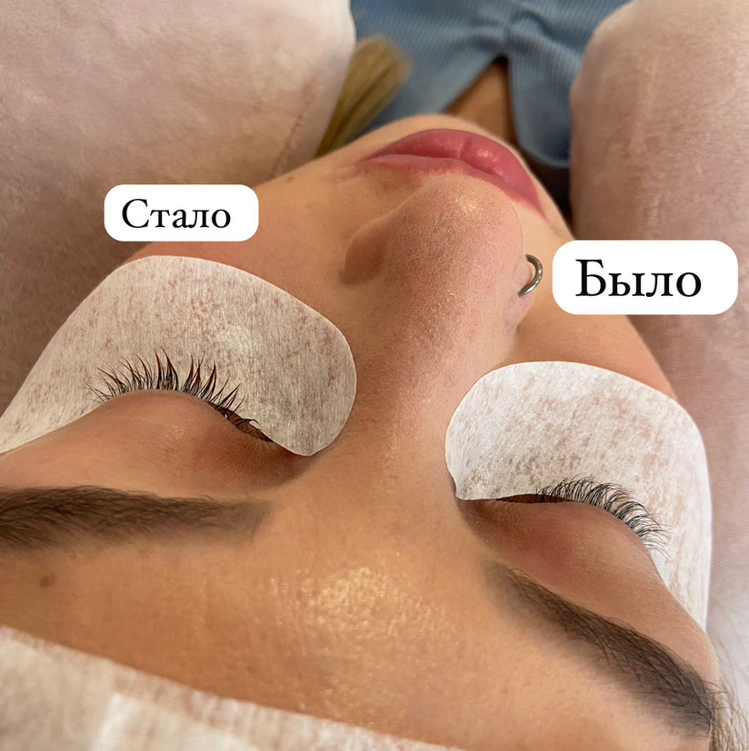 Деламинирование ресниц