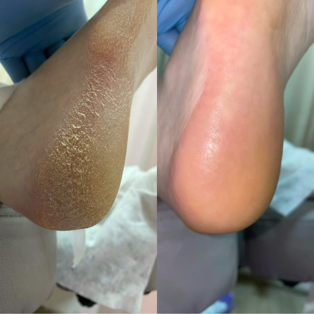 Педикюр без покрытия