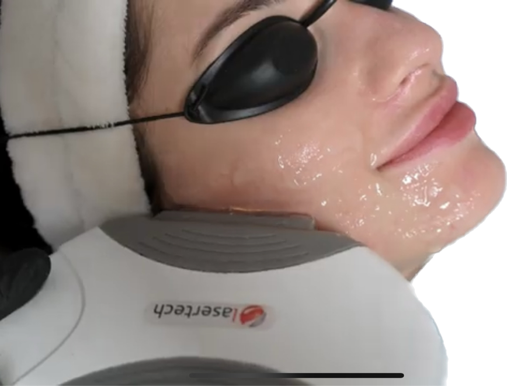 Элос омоложение - лицо +шея