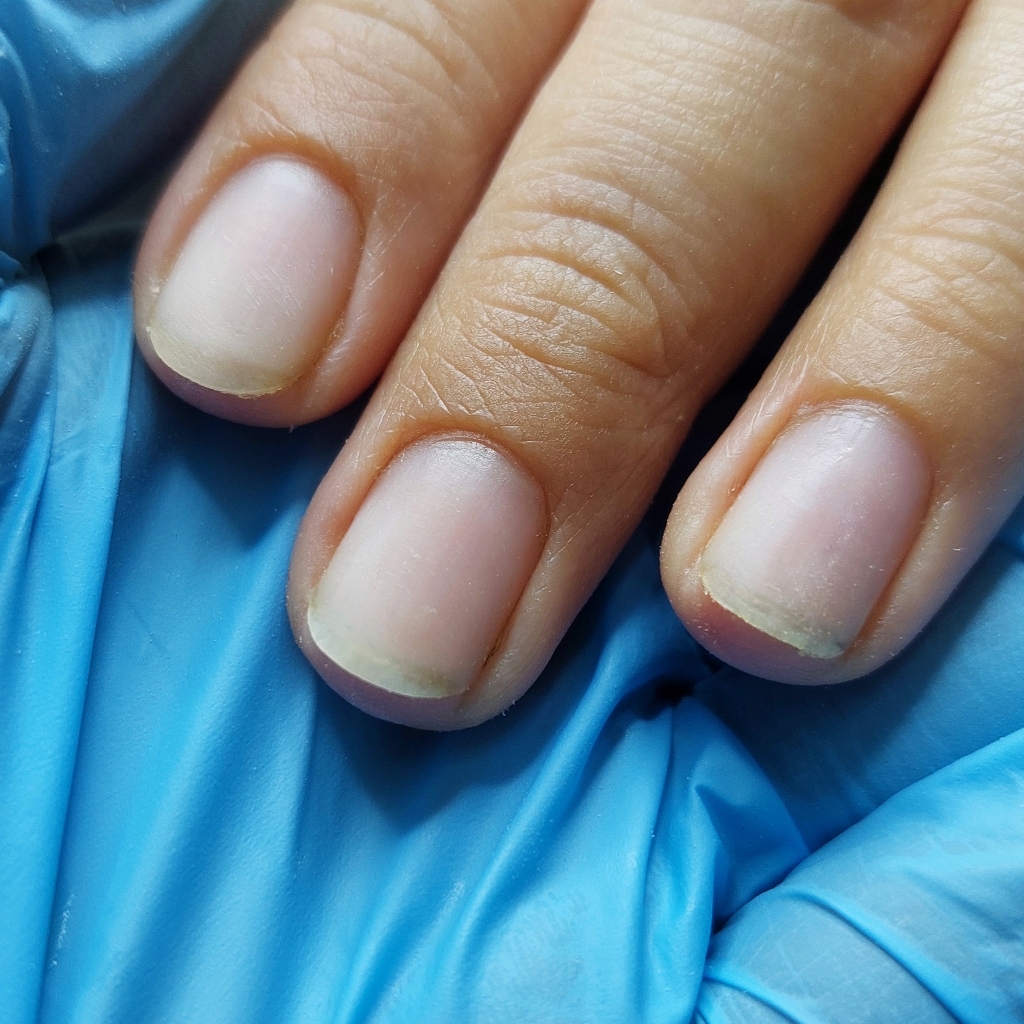 Полное снятие