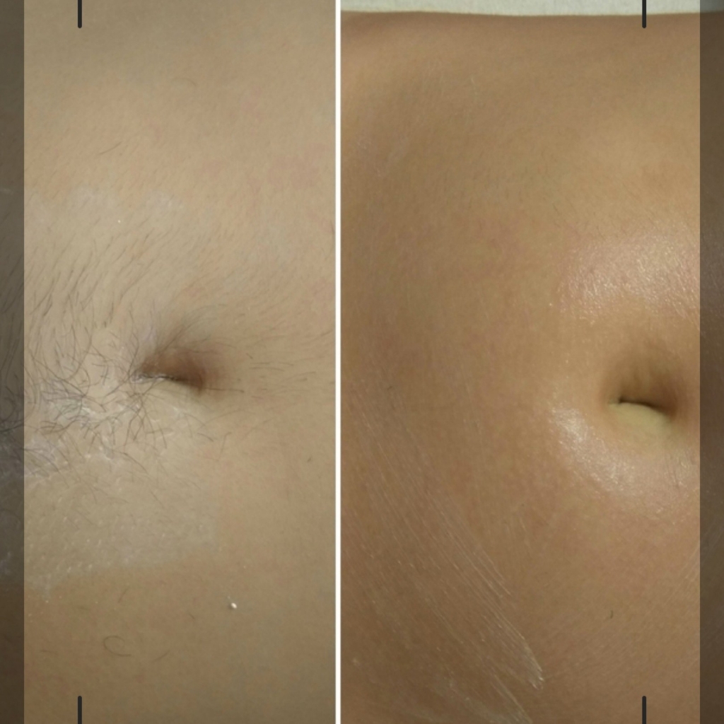 Живот полностью