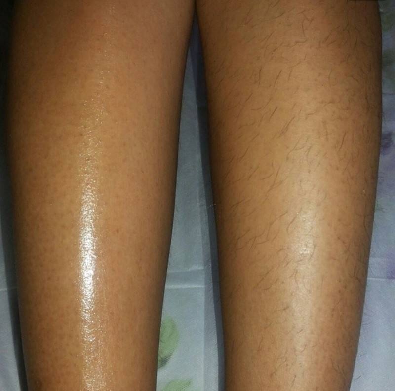 Ноги полностью