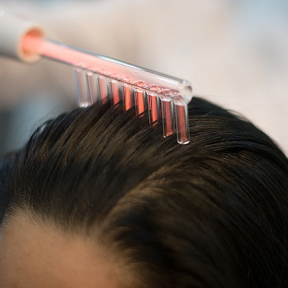 Дарсонвализация кожи головы