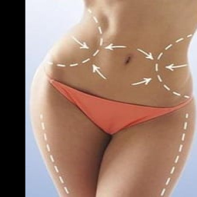 Изящный силуэт, 3-этапная комплексная программа - детоксикация, уменьшение объемов, лифтинг