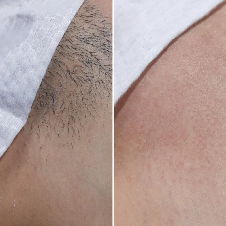 Бикини полностью