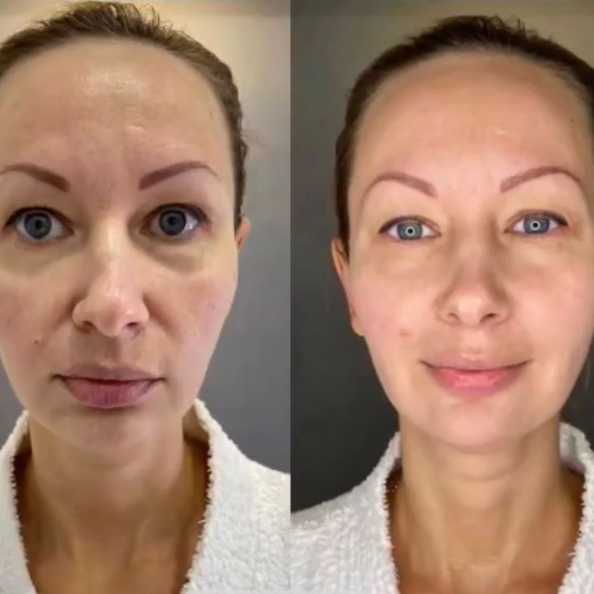 Массаж лица лифтинг скульптурный 60 мин с нанесением маски