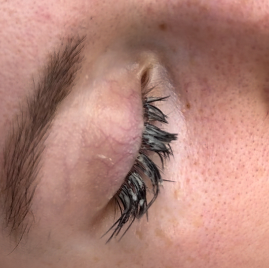 Снятие без наращивания