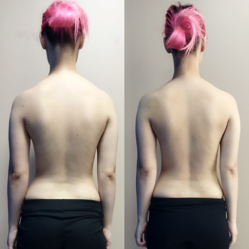 Юмейхо подросткам(13-17 лет)