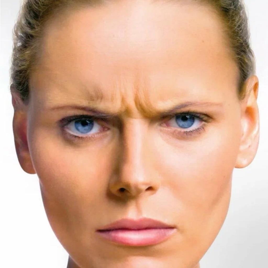 Межбровные морщины