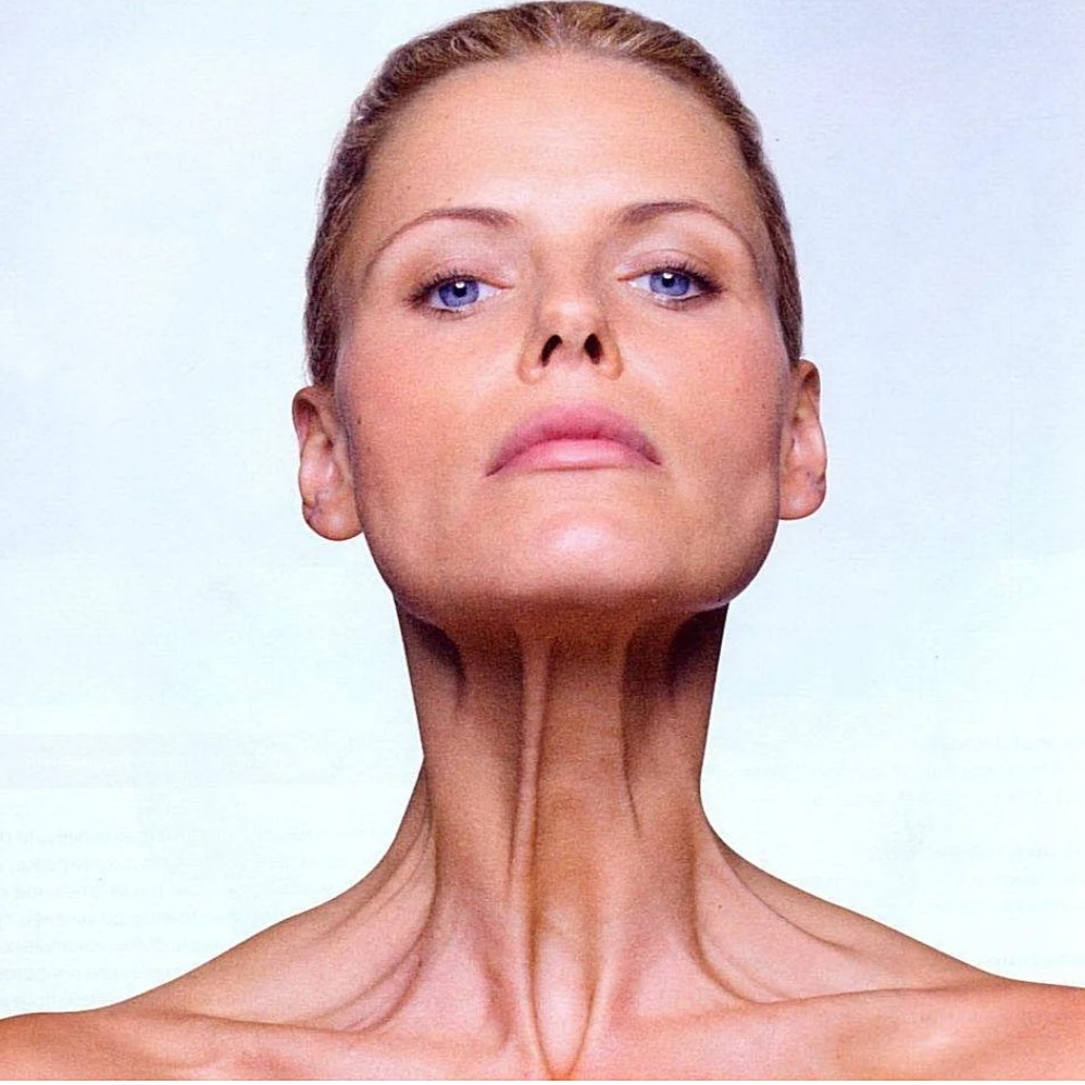 морщины шеи