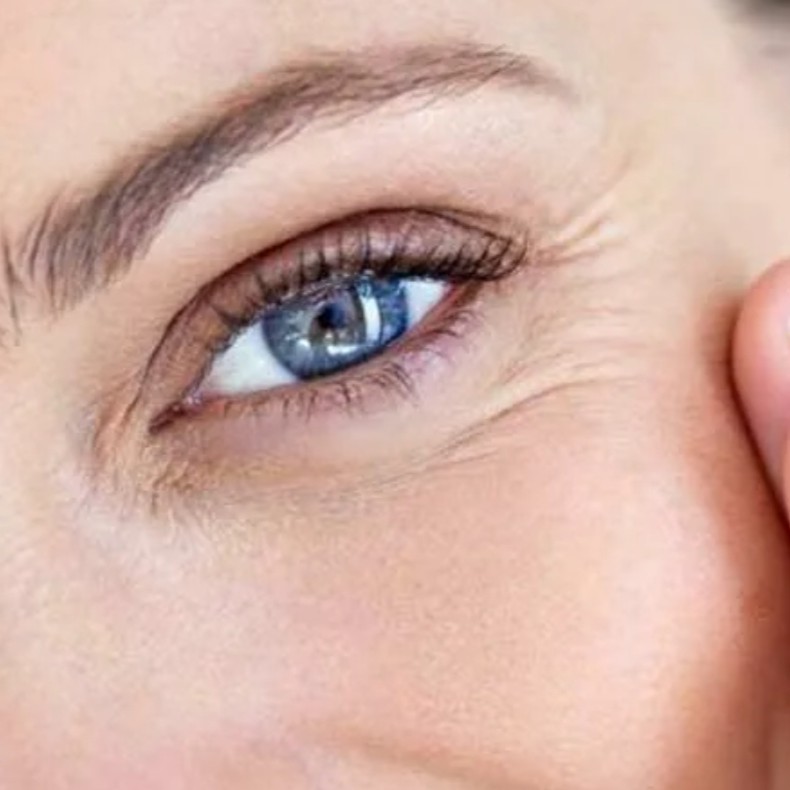 морщины глаз