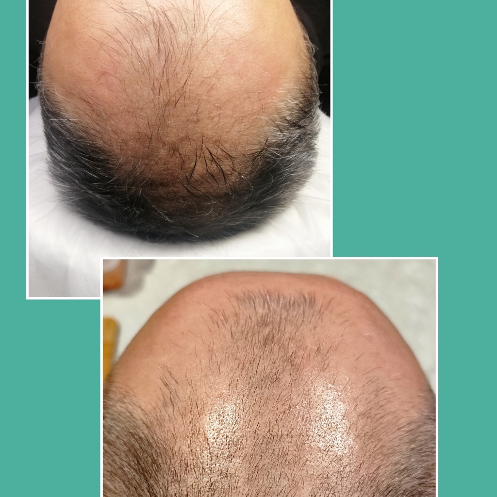 Восстановление волос