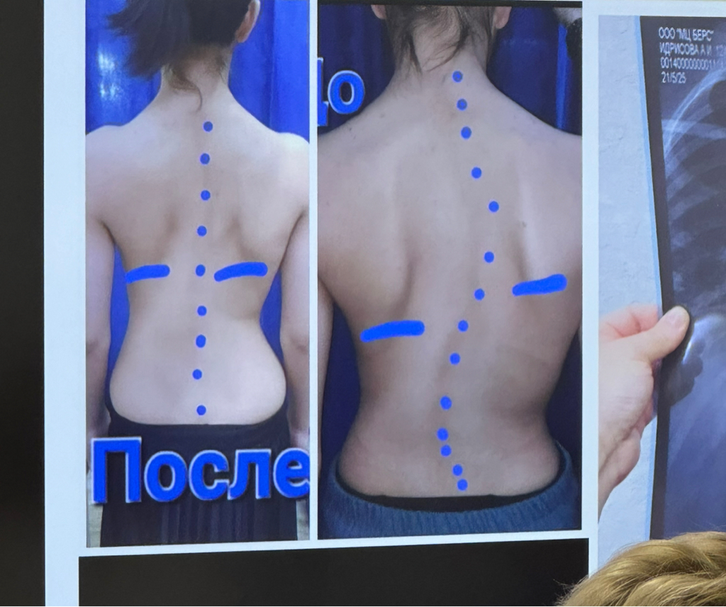 Массаж БИОЭНЕРГЕТИЧЕСКИЙ СПИНА+РУКИ+НОГИ с элементами техники ЭФФЕКТ ИГЛОУКАЛЫВАНИЯ ,,ДЫХАНИЕ ДРАКОНА,,