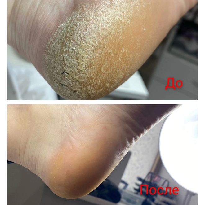 Гигиеническая обработка стоп