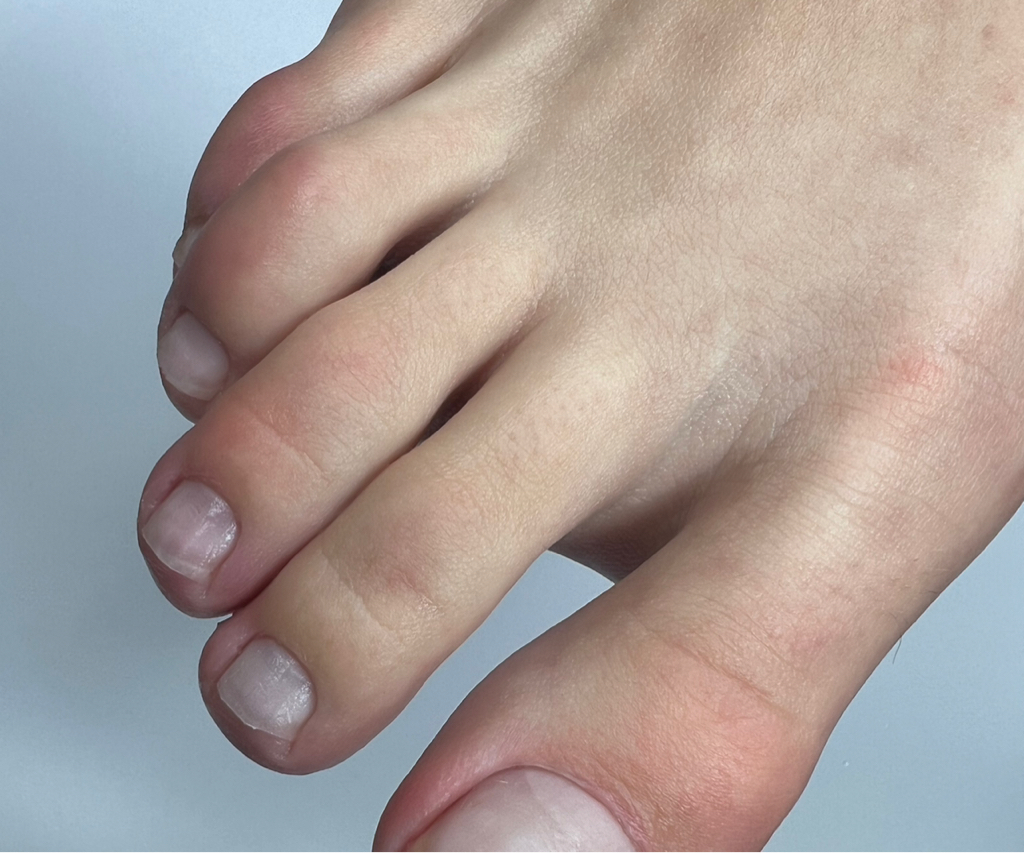 Педикюр без покрытия ( обработка стоп и пальчиков)