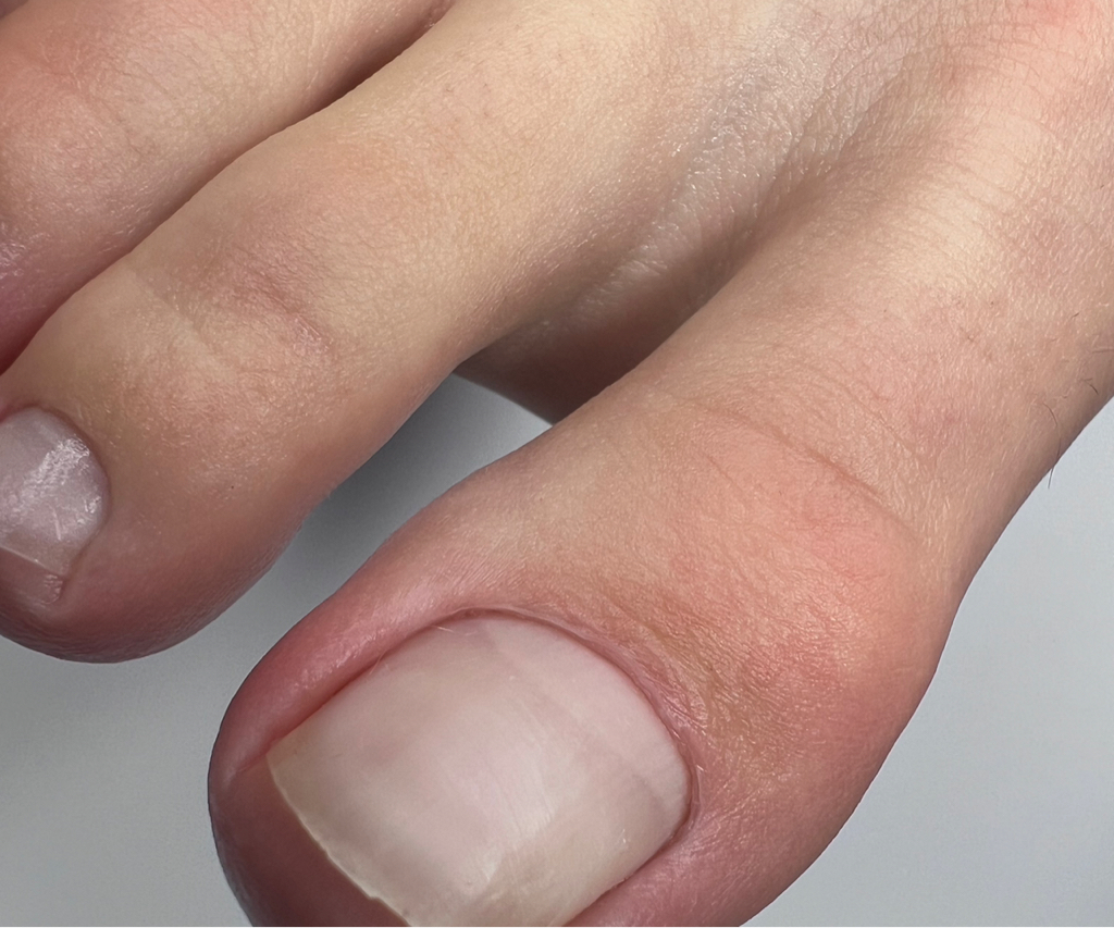 Педикюр ( обработка только пальчики)