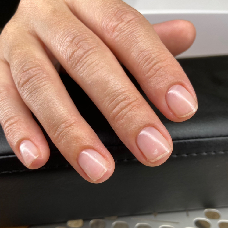 Лечебное покрытие CVC