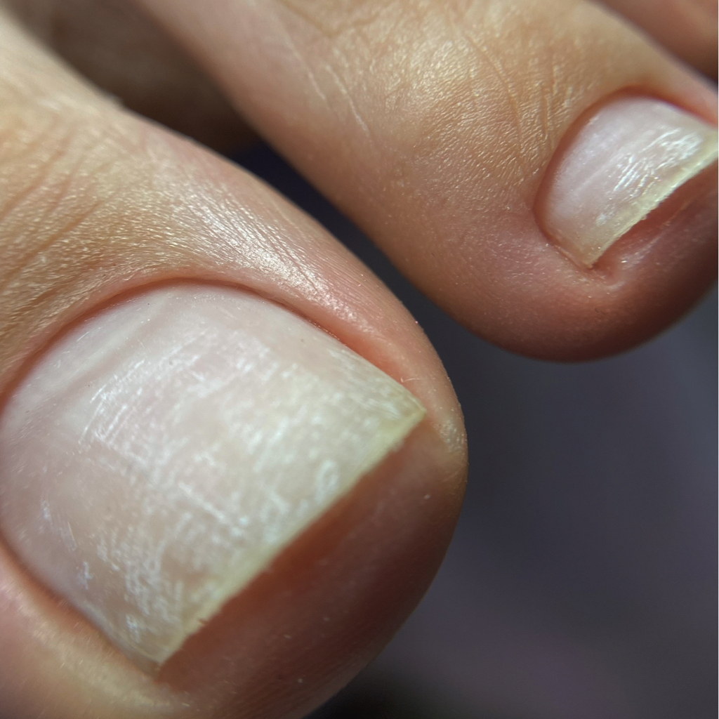 Педикюр гигиенический без покрытия