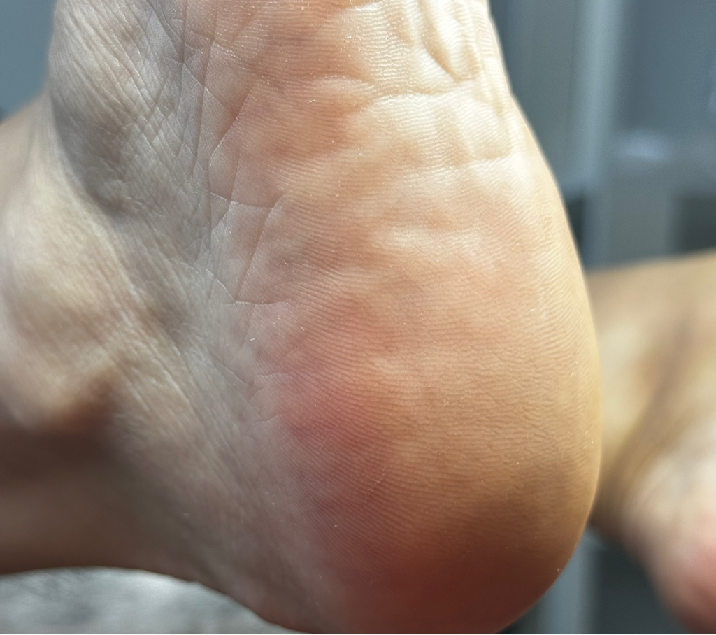 Педикюр гигиенический стопа + обработка пальцев без покрытия