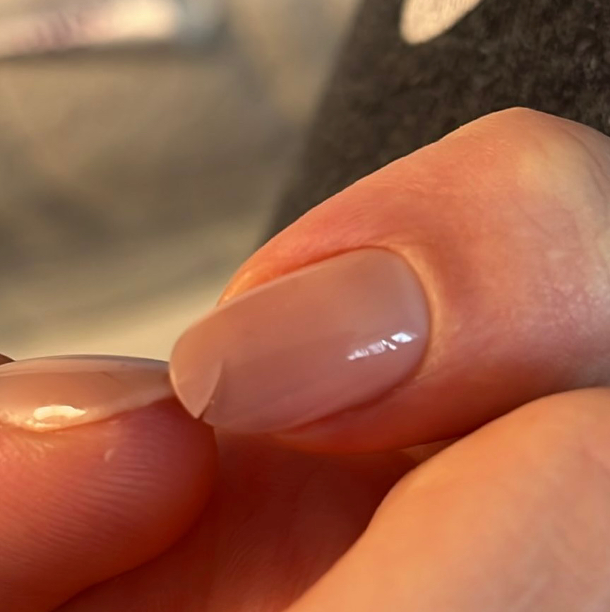 051. Reparatur 1 Fingernägel