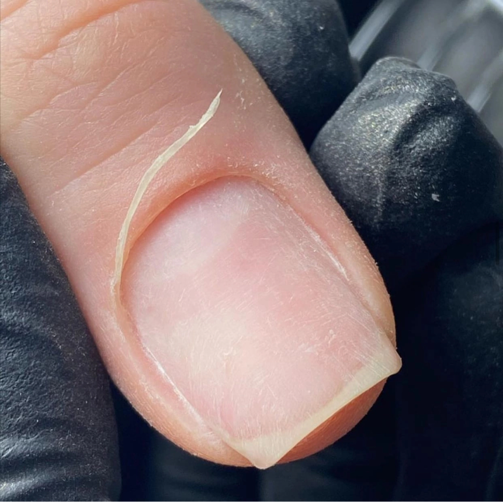 Полное снятие без покрытия