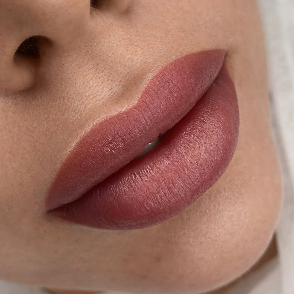 Коррекция пм губ не позже 2-х месяцев