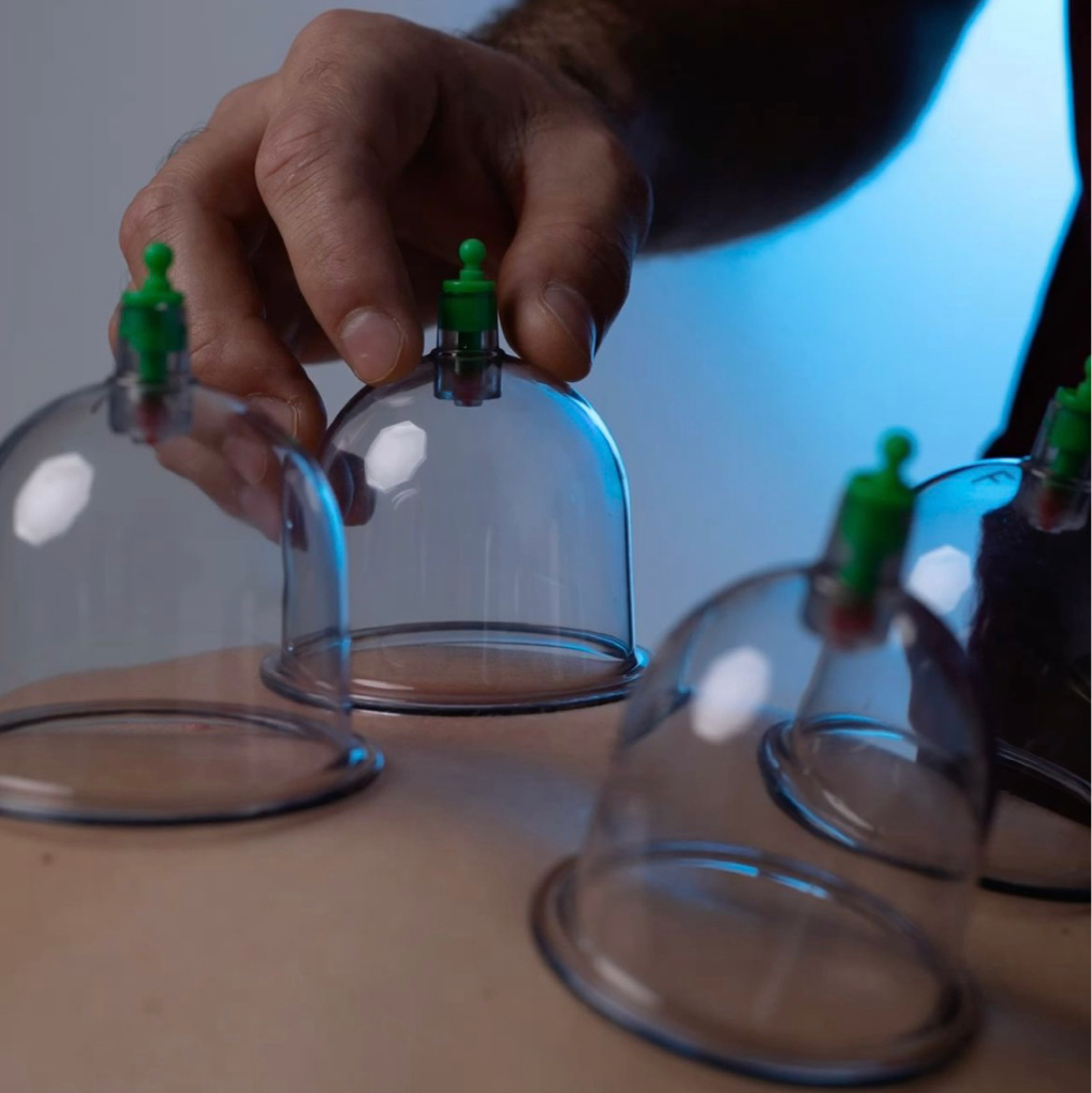 Баночная терапия