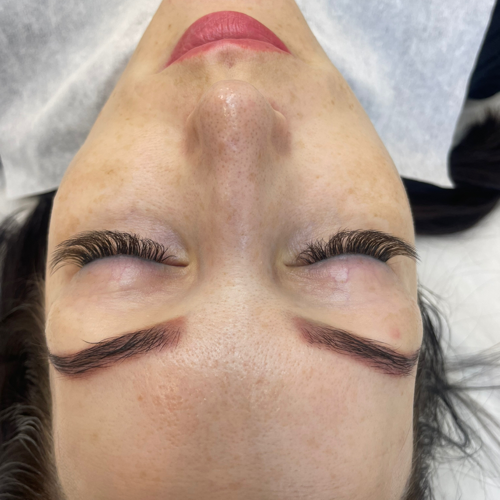 Пилинг Джеснера DermaTime (Испания)