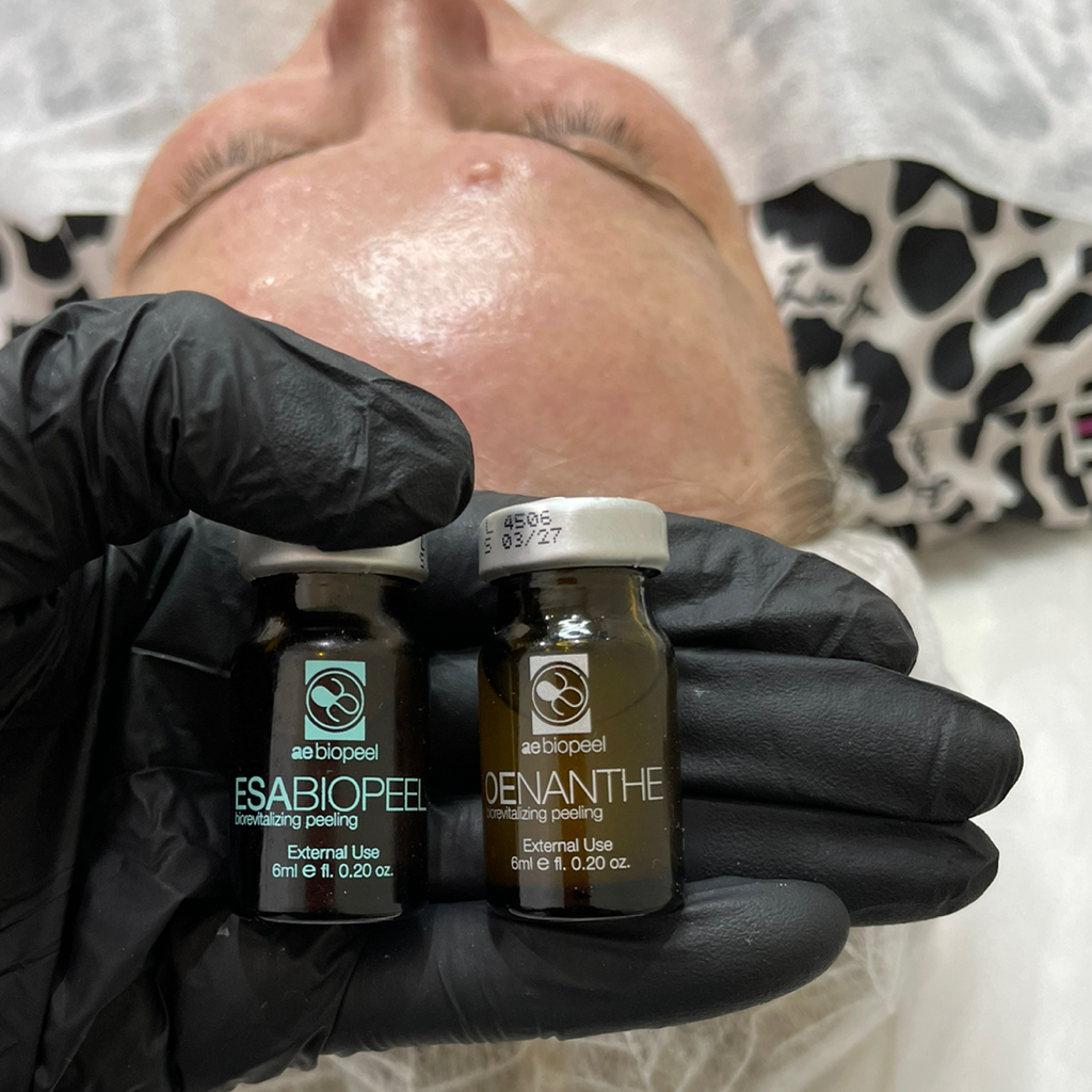 Пилинг-бионвитализант с ботулиноподобным эффектом Esa BioPeel + чистка ультразвуковая