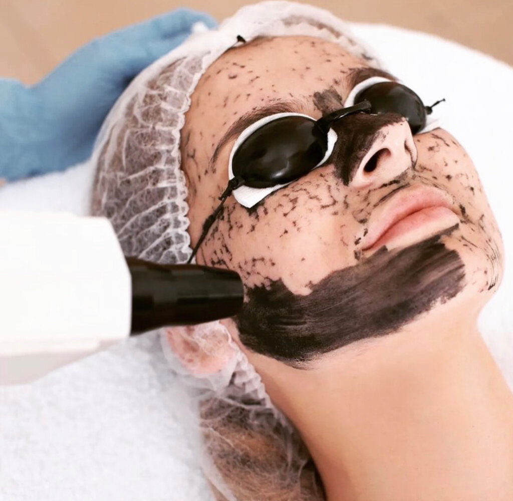 Уходовый комплекс «Сияющая кожа» (Карбоновый пилинг + сыворотка+ маска+ крем). Сияющая и свежая кожа после процедуры 🧖‍♀️