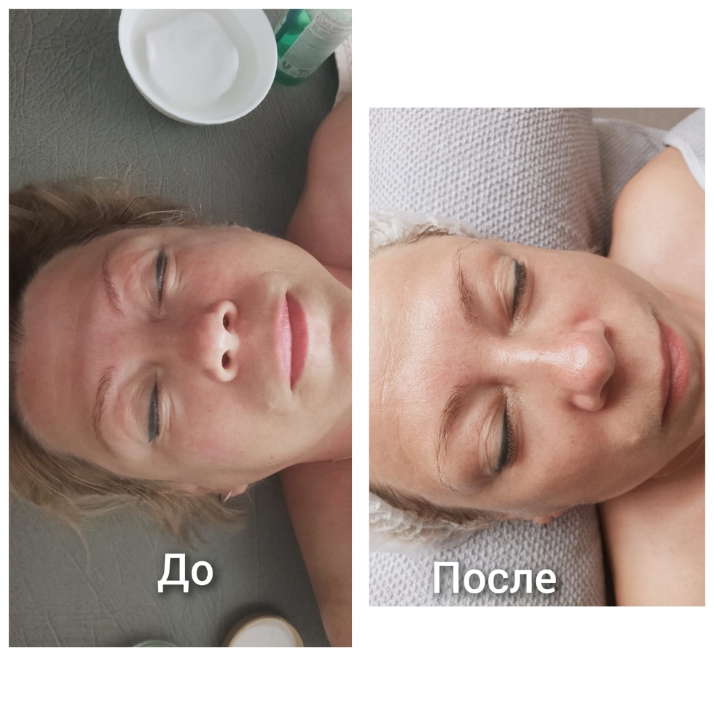 Комбинированный массаж лица(авторская работа)