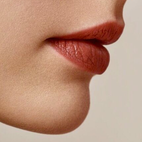 Лазерная эпиляция «подбородок»