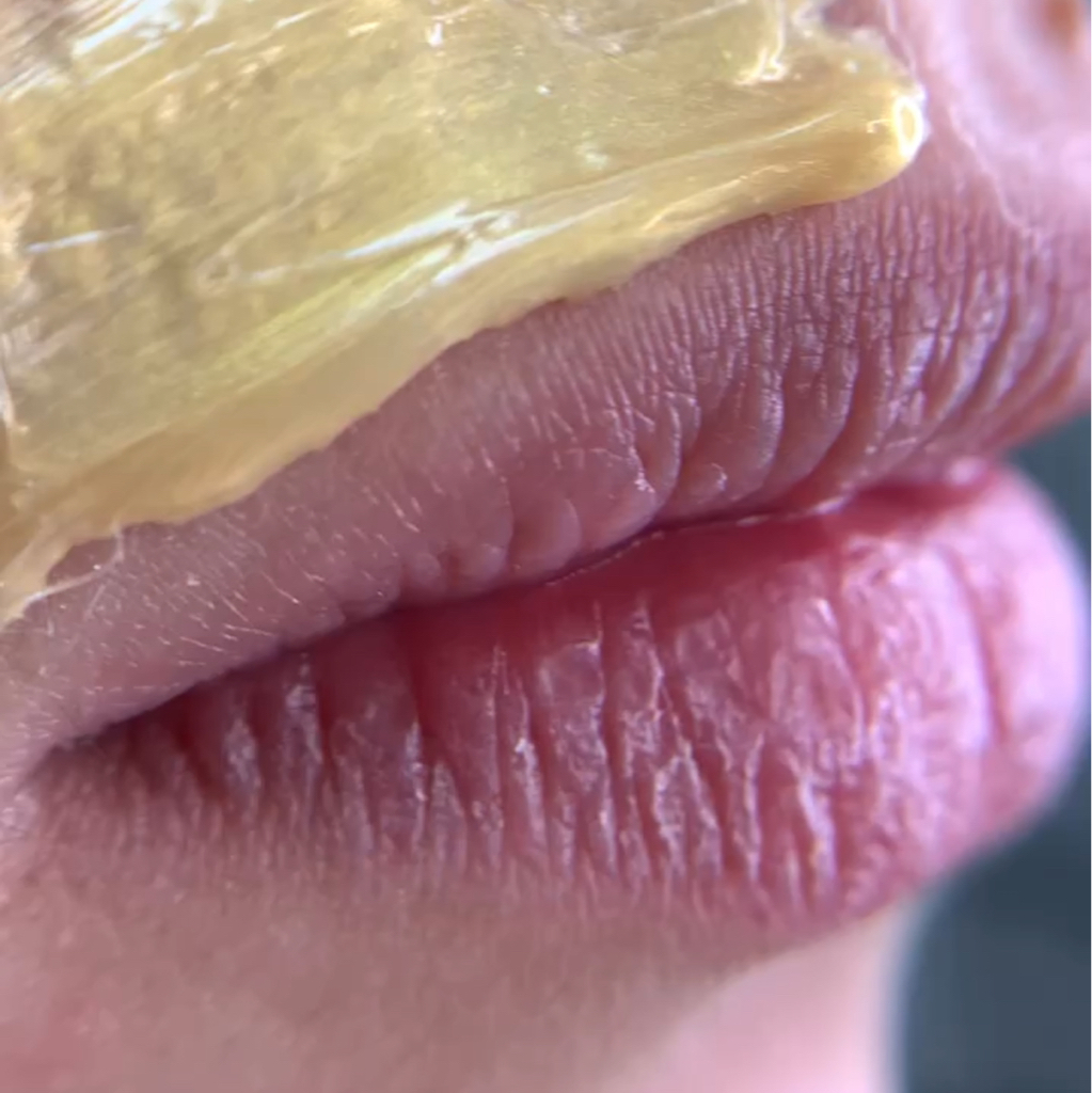 Эпиляция растительности на лице (над губой, в носу, бакенбарды)