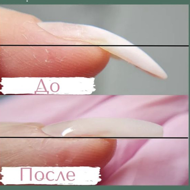 Исправление клюющих ногтей / донаращивание (ноготь)