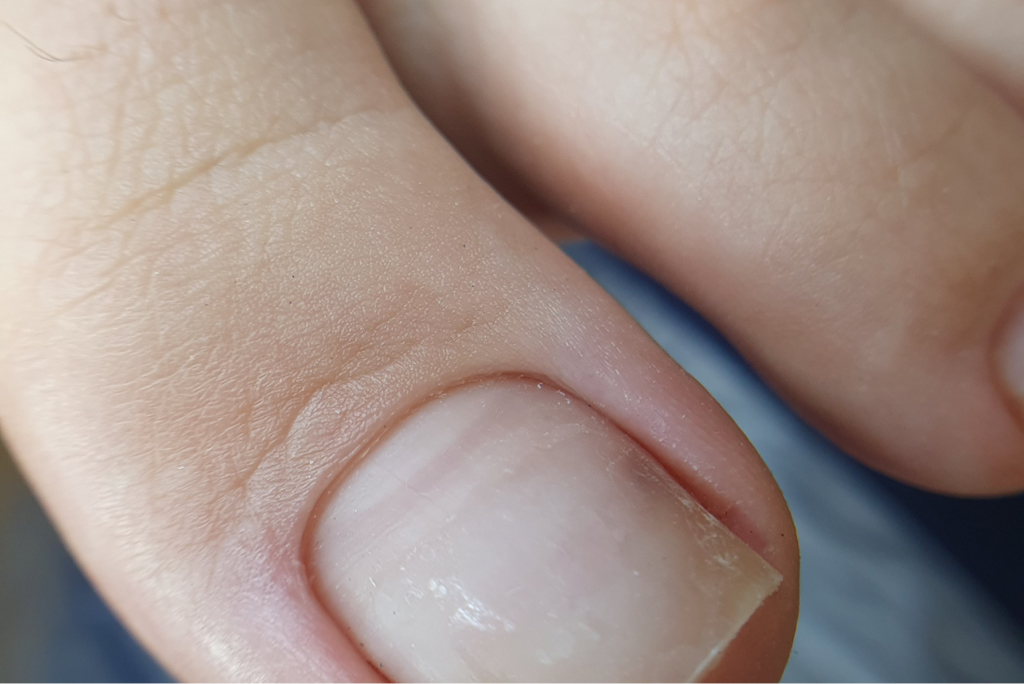 SMART педикюр (обработка стопы и пальцев ног)