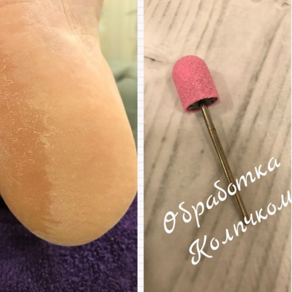 Педикюр Аппаратный экспресс