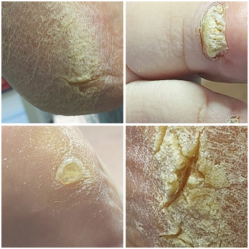 Полный парамедицинский педикюр