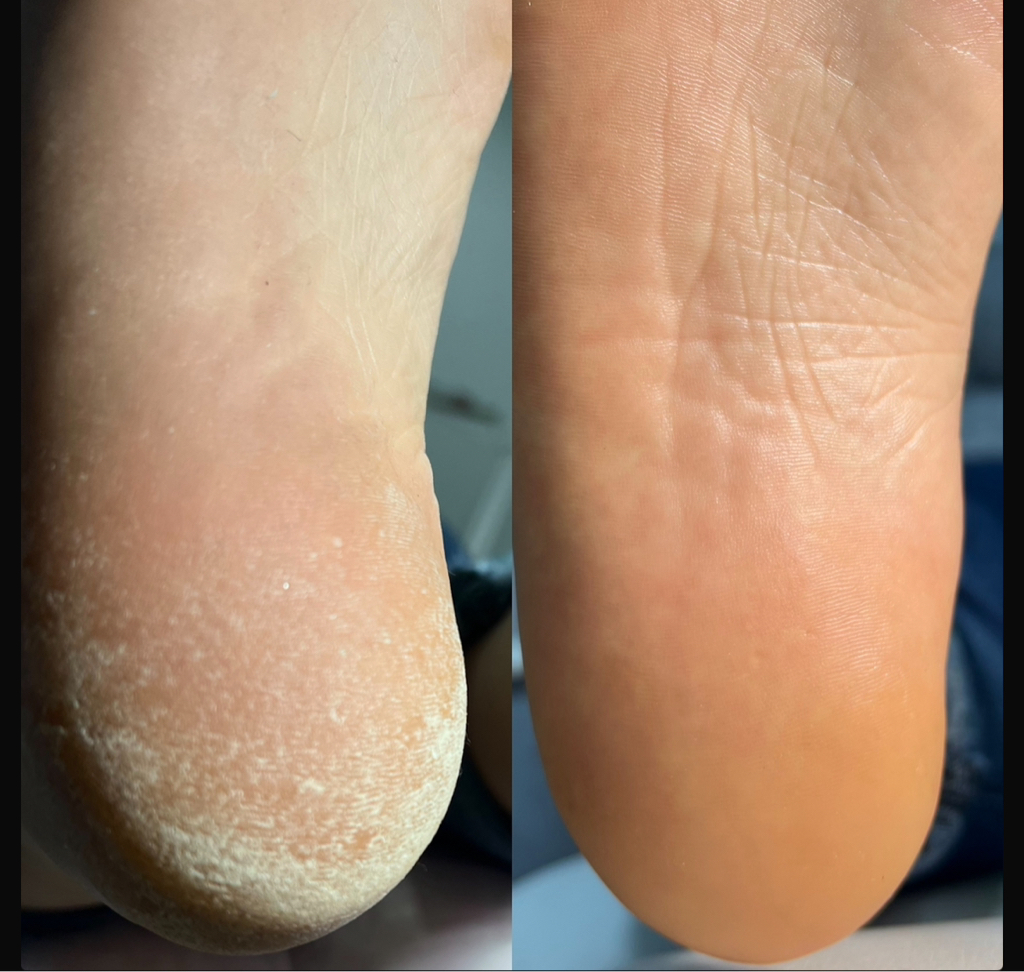 Педикюр полный