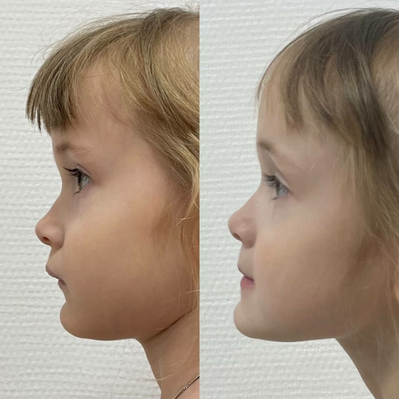 Детский массаж