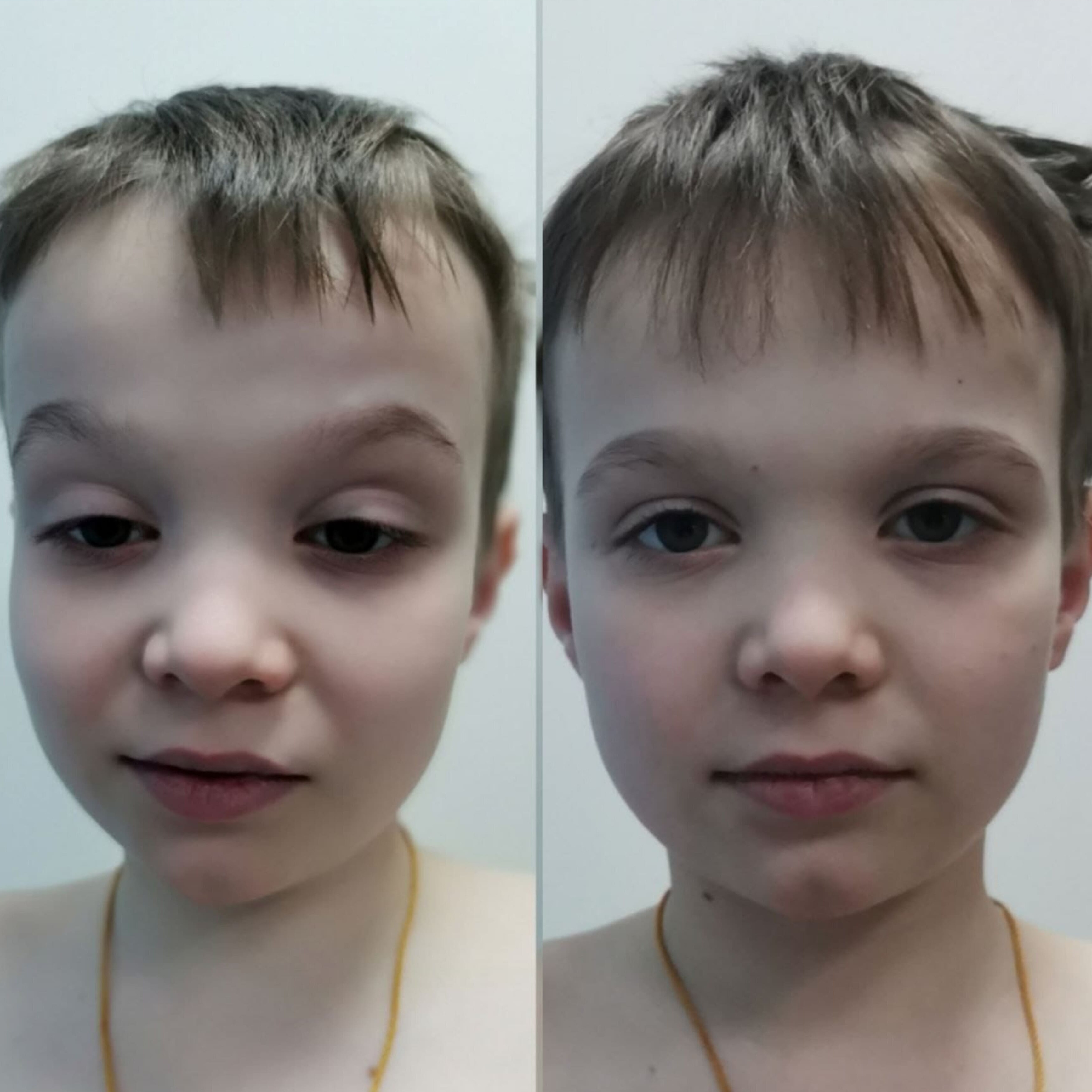 Массаж Головы