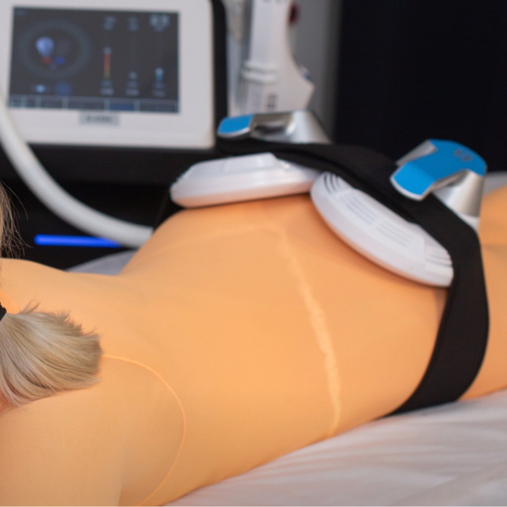 EMS Shape (АБОНЕМЕНТ 5 сеансов, 4 манипулы, 2 зоны)