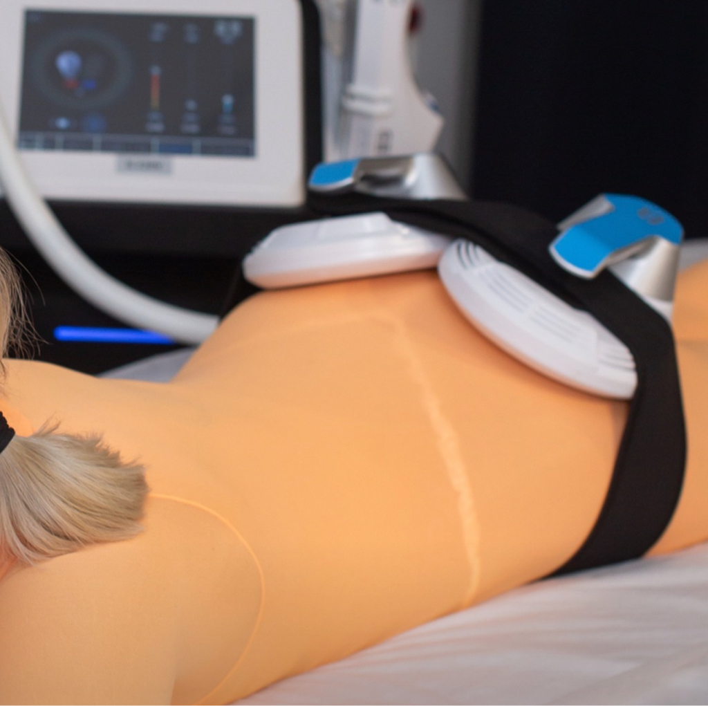 EMS Shape (АБОНЕМЕНТ 10 сеансов, 4 манипулы, 2 зоны)