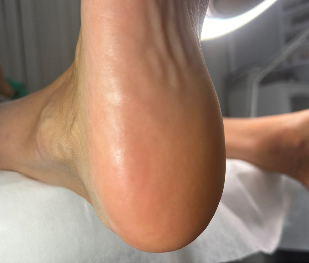 Обработка стопы