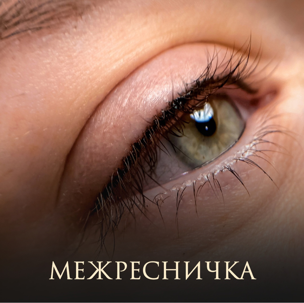 Межресничка классическая