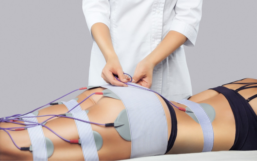 Миостимуляция