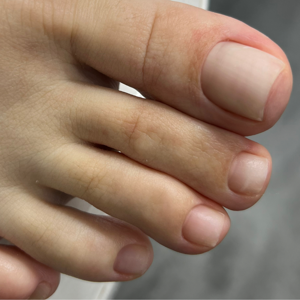 Гигиенический педикюр (обработка пяток и стоп+пальчики)