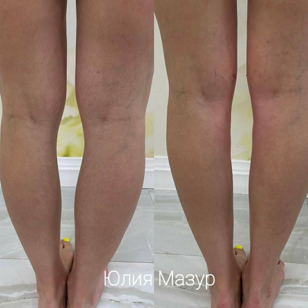 Коррекция икр г/к (100мл)