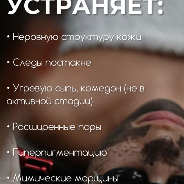 Карбоновый пилинг